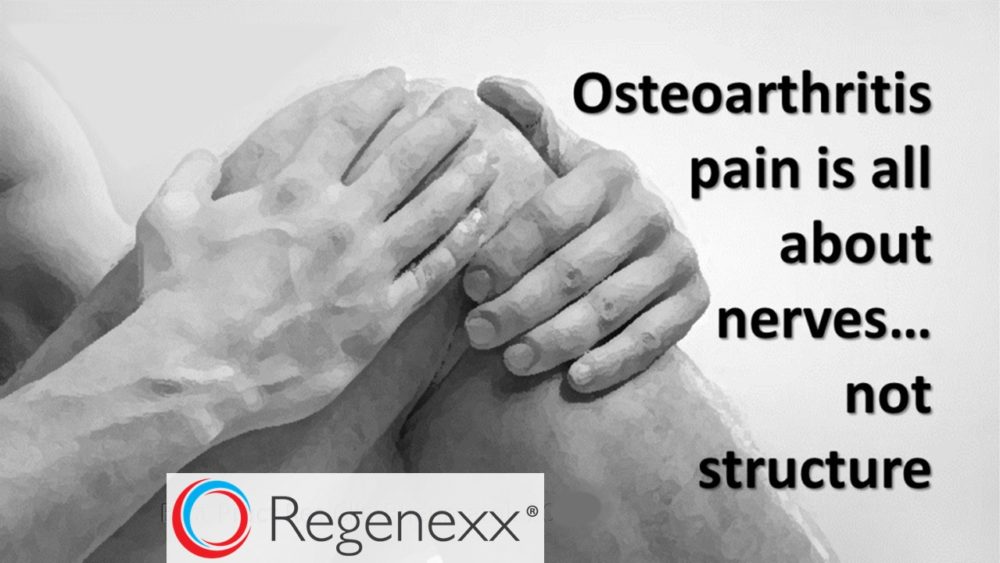 Osteoarthritis Pain Not Related to Structure – Again…