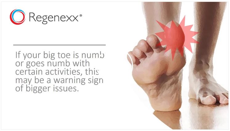 Why Is My Big Toe Numb Regenexx 