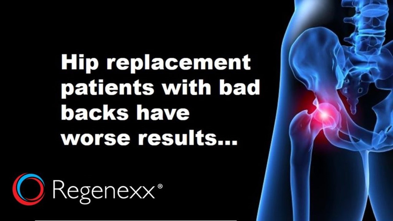 hip-replacement-back-pain-how-many-hips-that-don-t-hurt-get-replaced