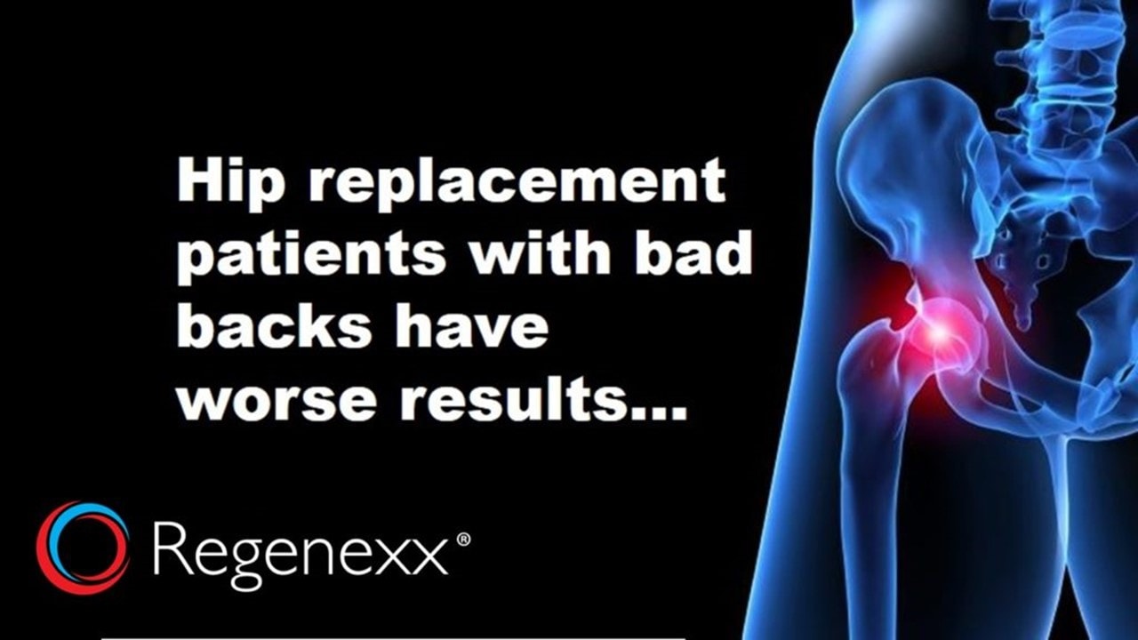 Hip Replacement Back Pain How Many Hips That Don t Hurt Get Replaced 