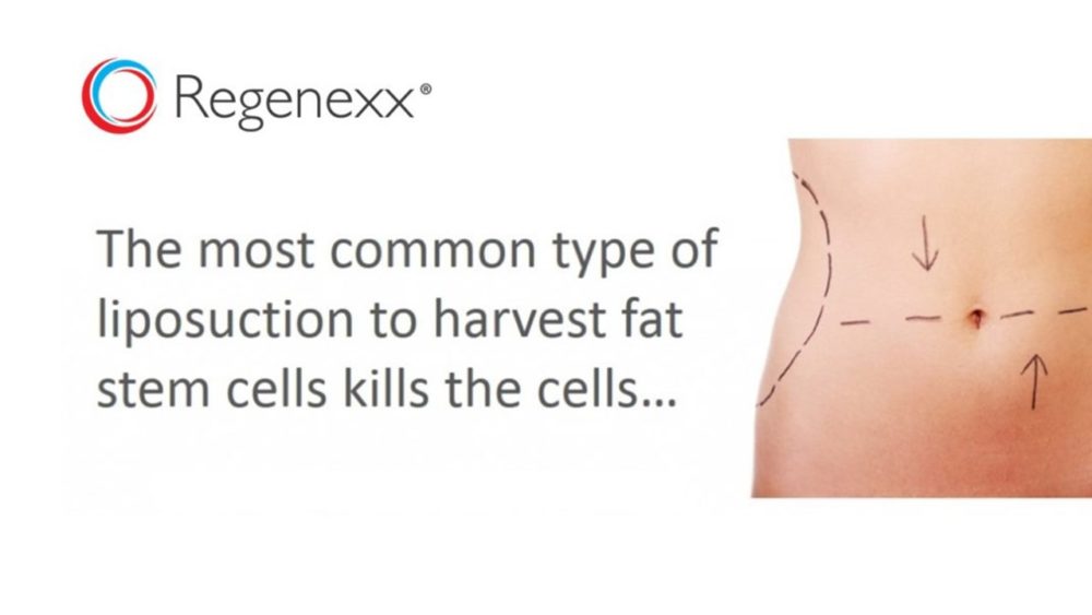 Why Most Fat Stem Cells Harvested via Liposuction are DOA…