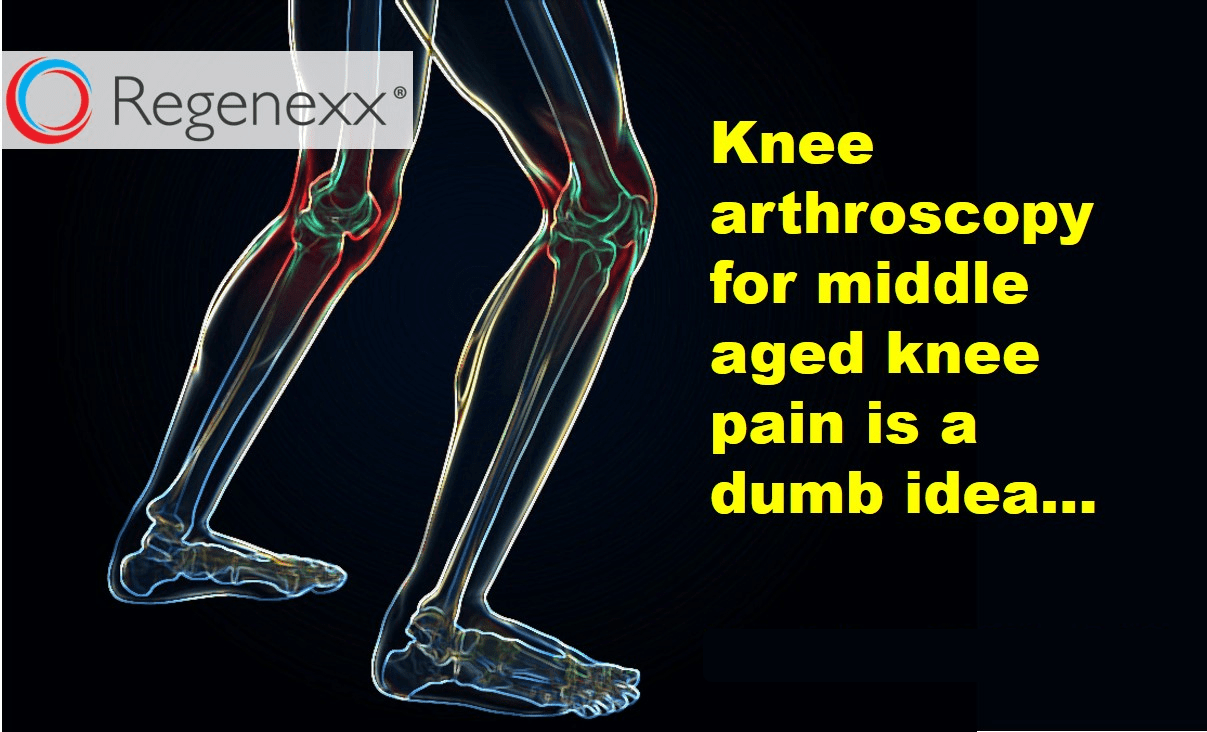 knee-surgery-for-a-meniscus-tear-not-if-you-re-middle-aged