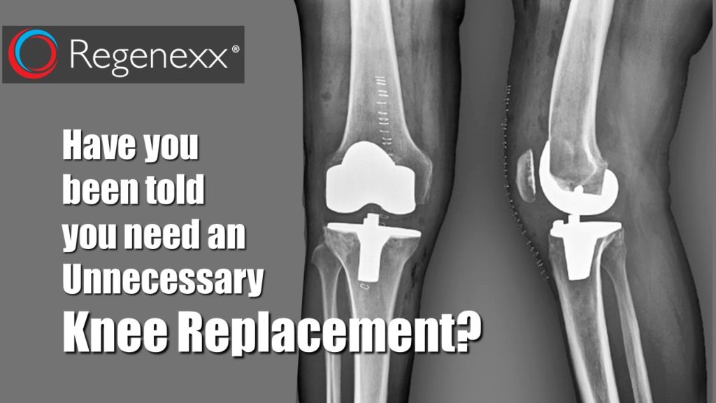 unnecessary knee replacements