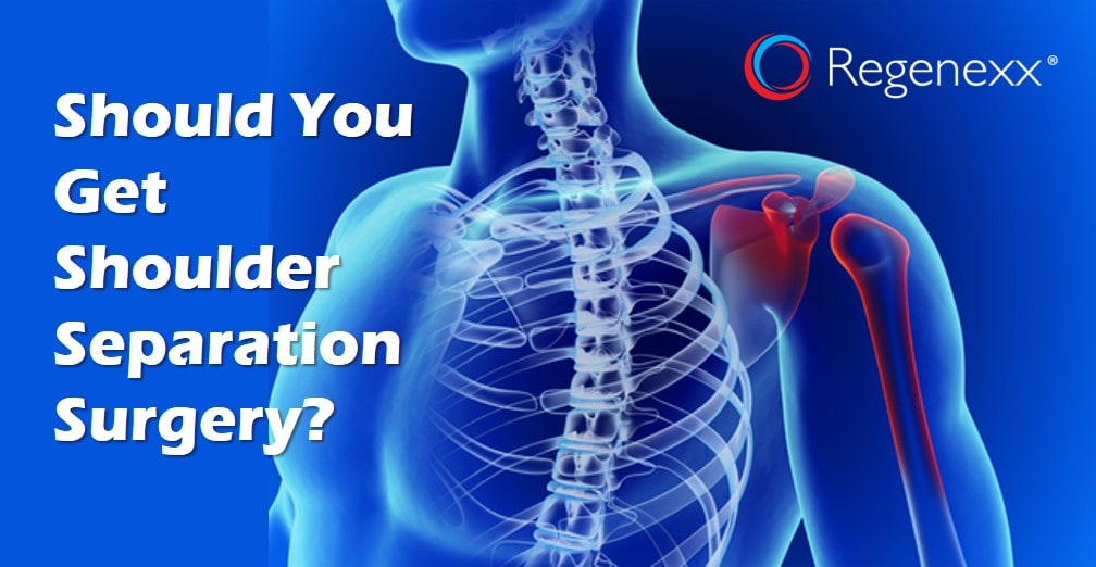 Separated Shoulder Pain Years Later Research Shows You Don t Need 