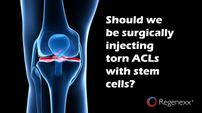 Stem Cell Therapy For Acl Tears Non Surgical Treatment