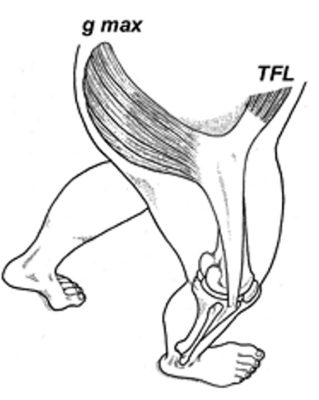 medical illustration of the gluteus maximus, TFL, and ITB. 