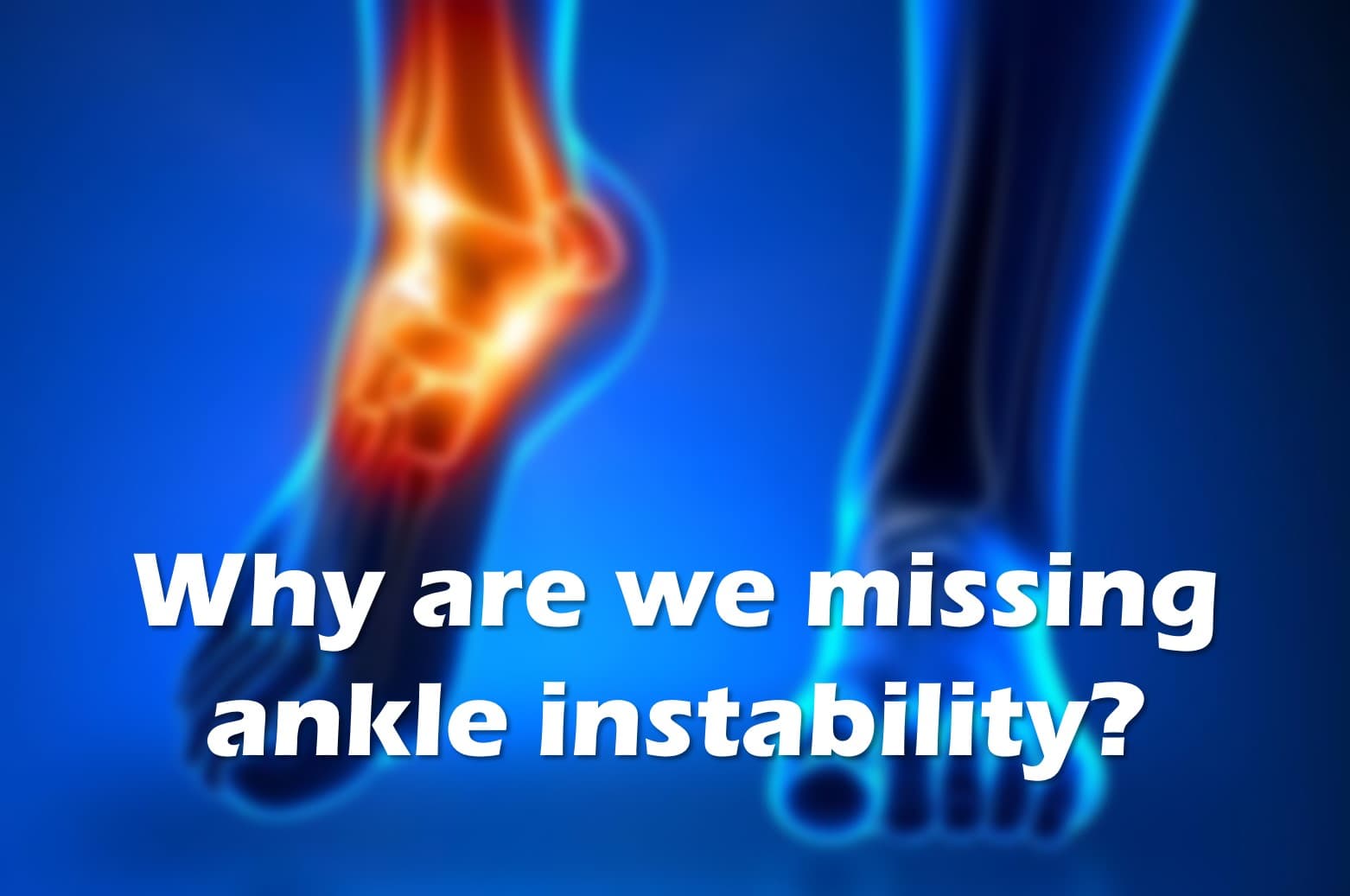 what causes ankle arthritis