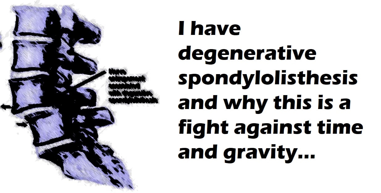 what is degenerative spondylolisthesis