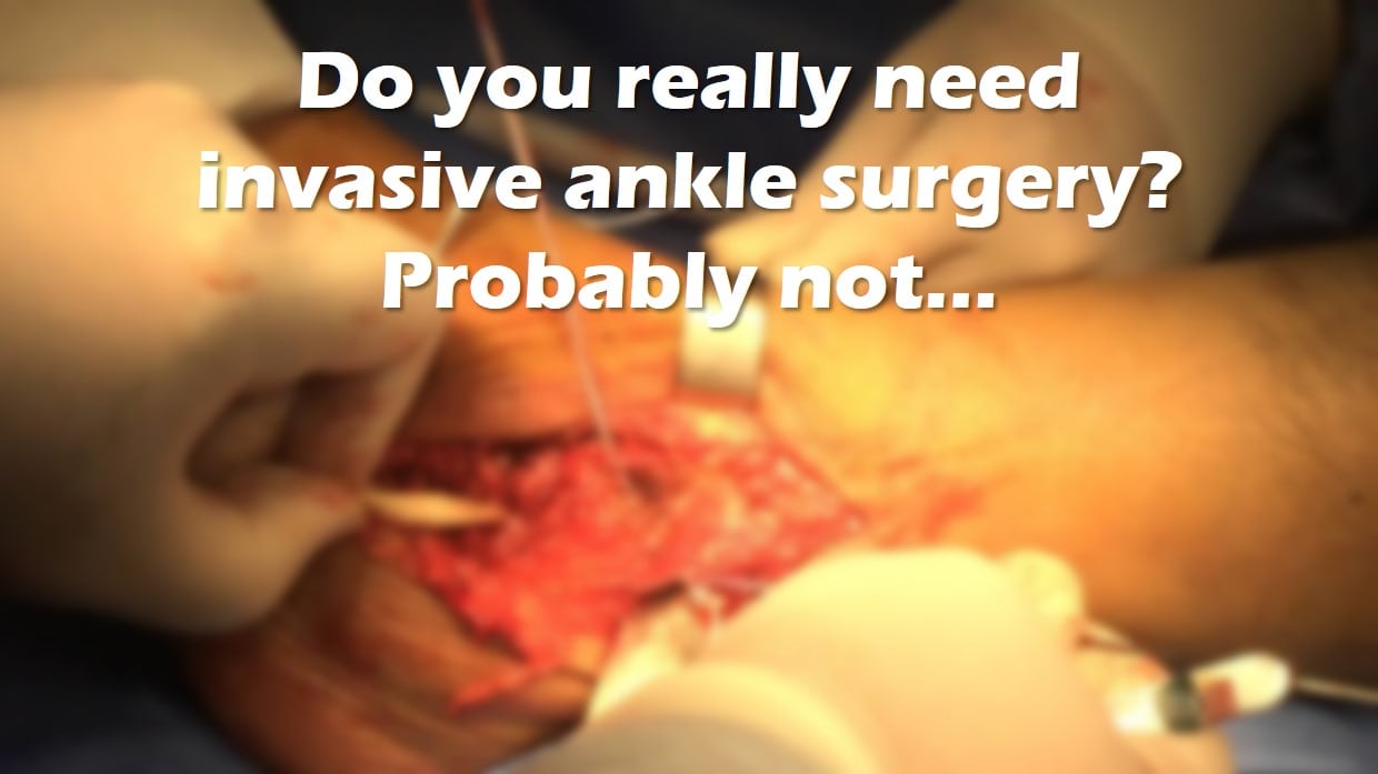 Torn ankle tendon surgery