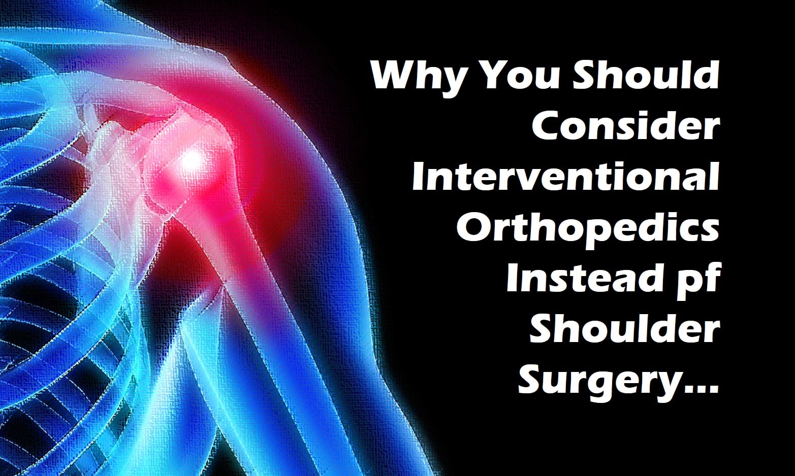 should you get shoulder surgery