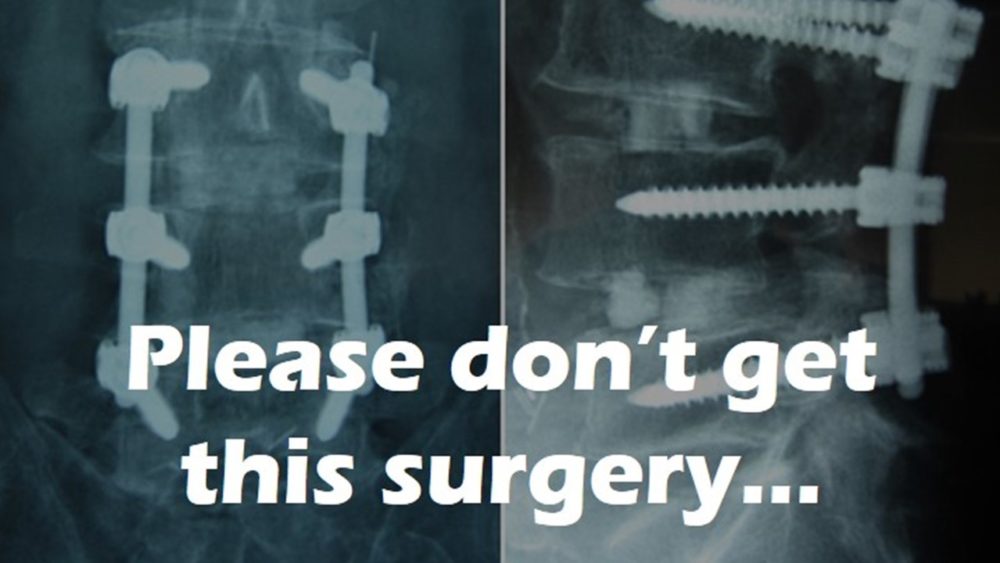 New Research: Low Back Fusion Surgeries Are Ineffective