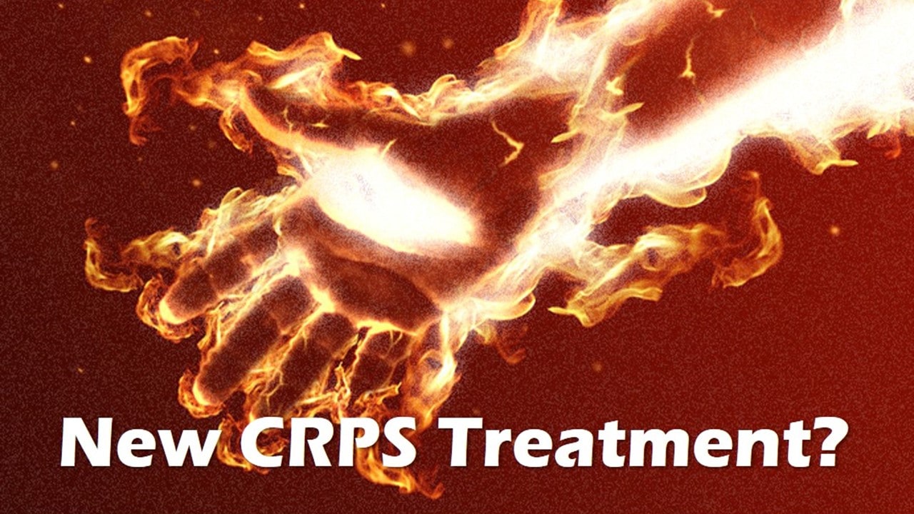new treatments for CRPSnew treatments for CRPS