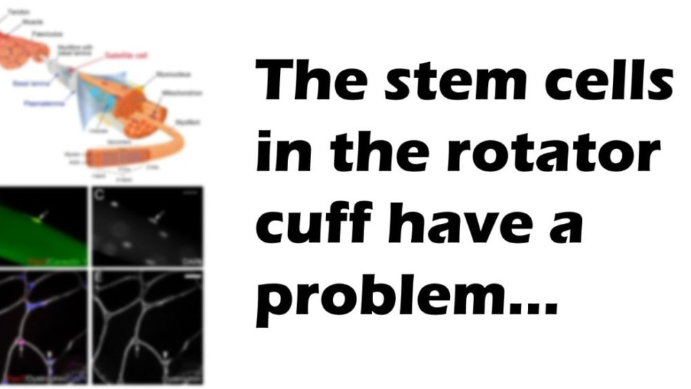 rotator cuff stem cell treatment
