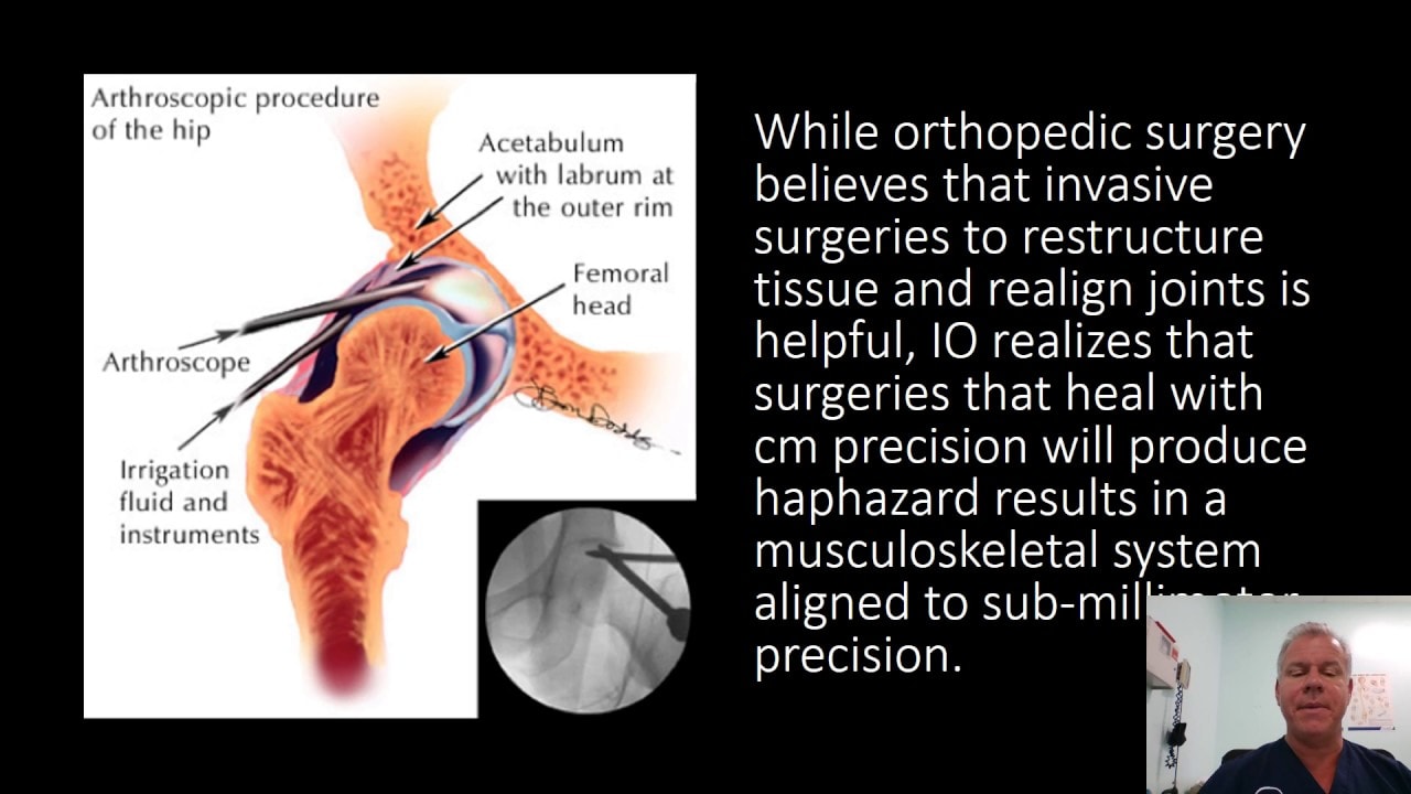 What’s the Difference between Interventional and Surgical Orthopedics?