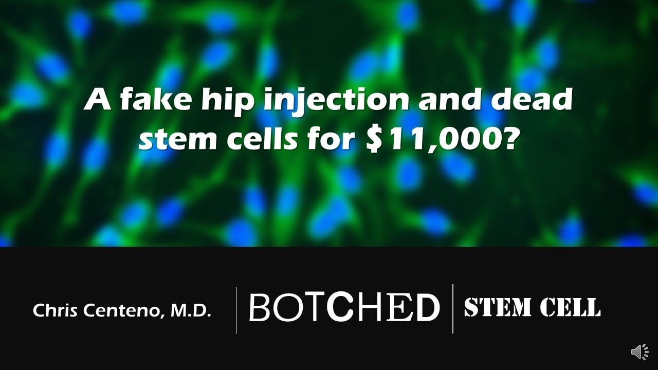 Hip Stem Cell Treatment Gone Wrong