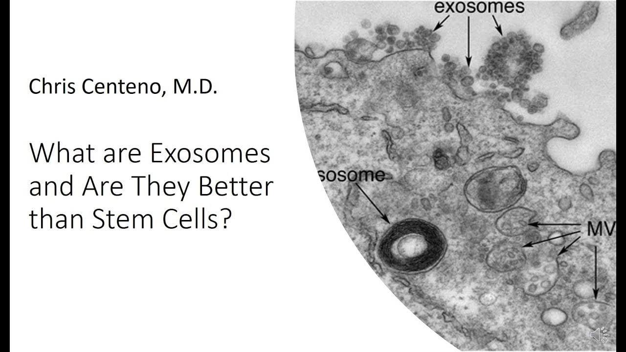What are Exosomes? Are They Better than Stem Cells?