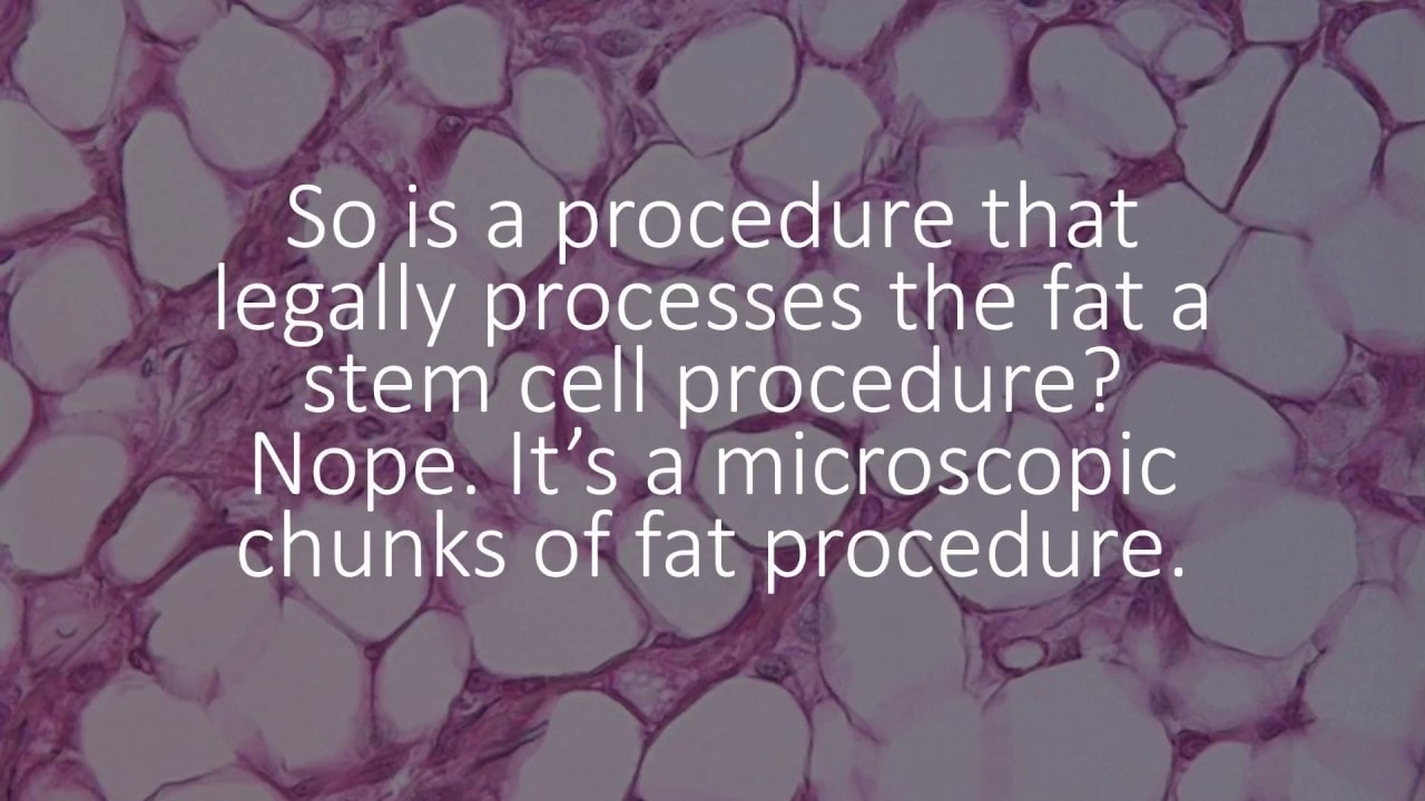 A Fat Graft vs a Stem Cell Procedure