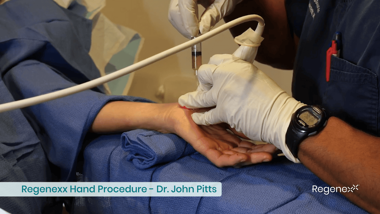 PRP to Treat Hand Arthritis and Trigger Finger