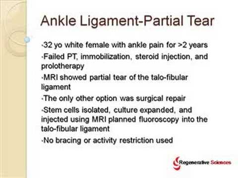 Ankle Ligament Tear