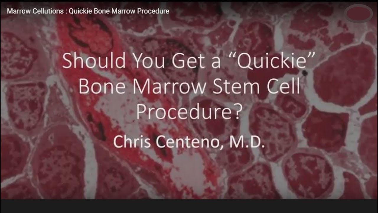 Marrow Cellutions : Quickie Bone Marrow Procedure
