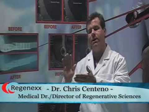 Regenexx Stem Cell Research