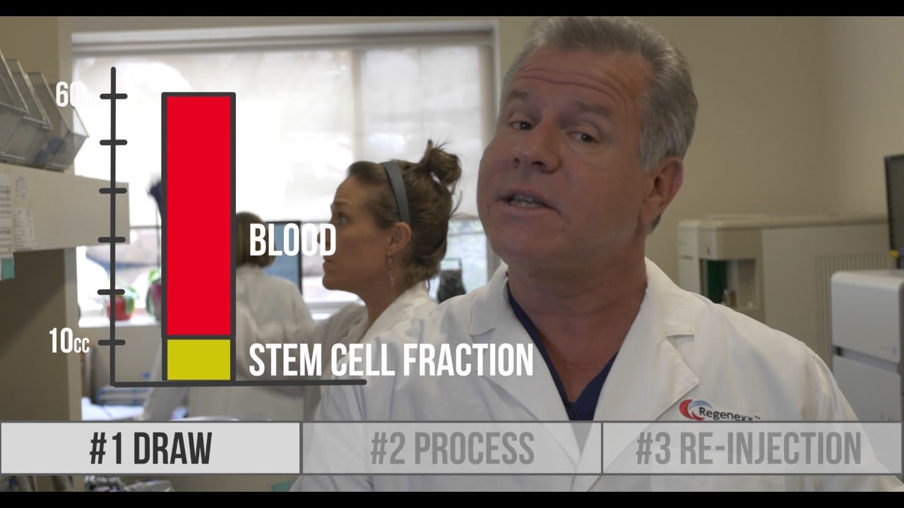 Why Regenexx Stem Cell Processing Is Very Different