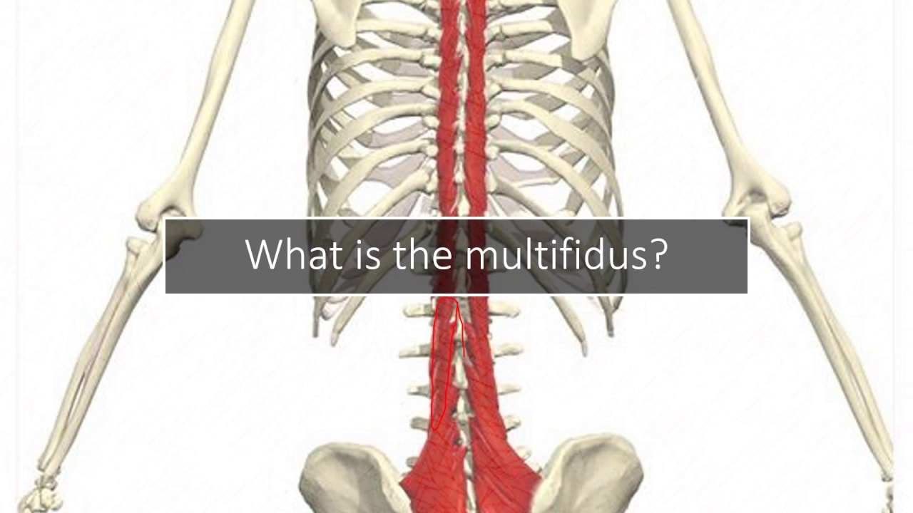 Multifidus Back Pain: Why Your Doctor Never Discussed It