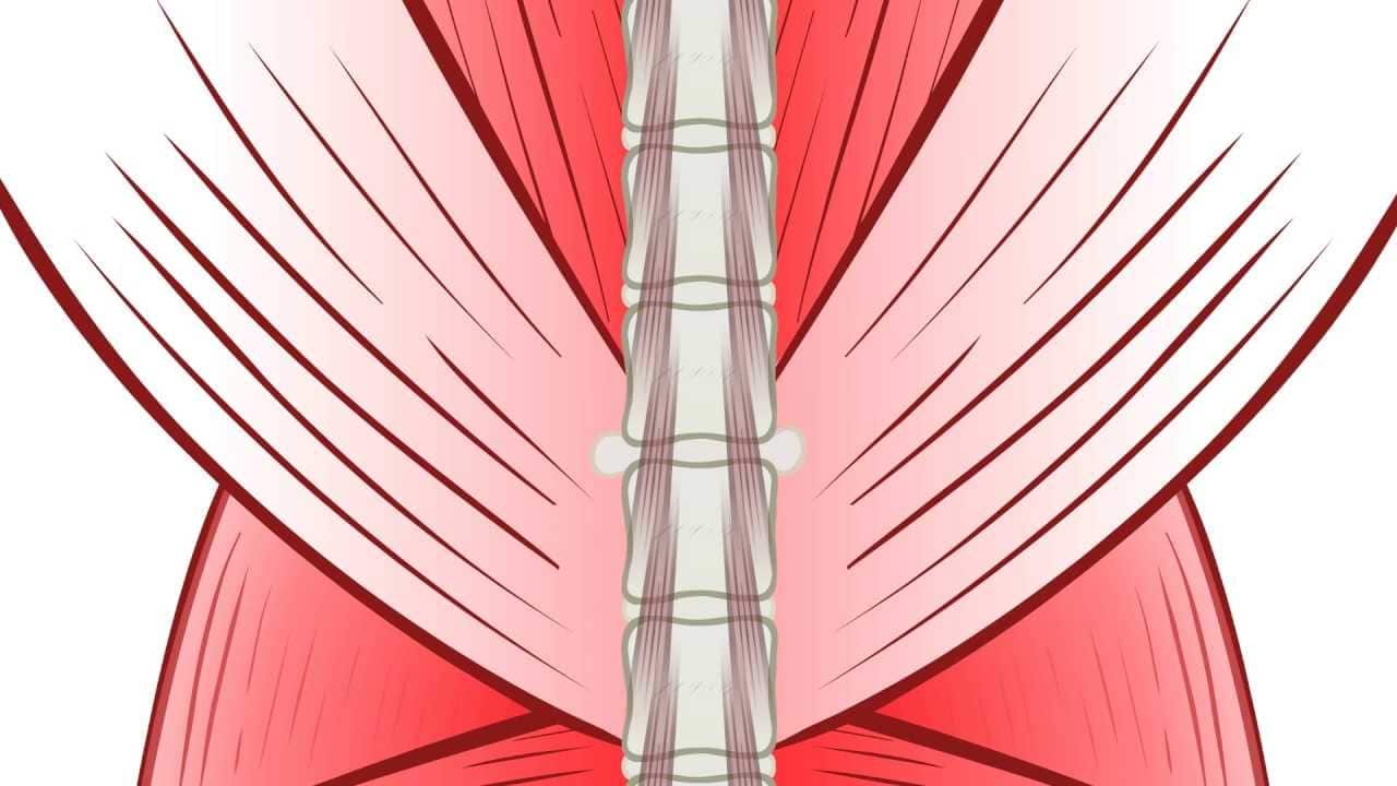 Regenexx PL-Disc Alternative to Back Surgery and Epidural Steroid Injections (Short)