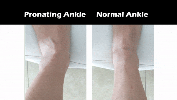 inside ankle collapse
