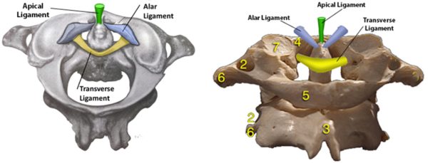 craniocervical instability measurements