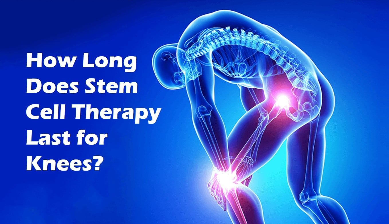 how long does stem cell therapy last for knees