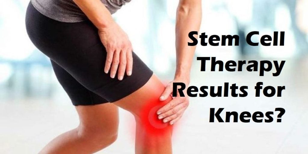 Stem Cell Therapy Results For Knees 