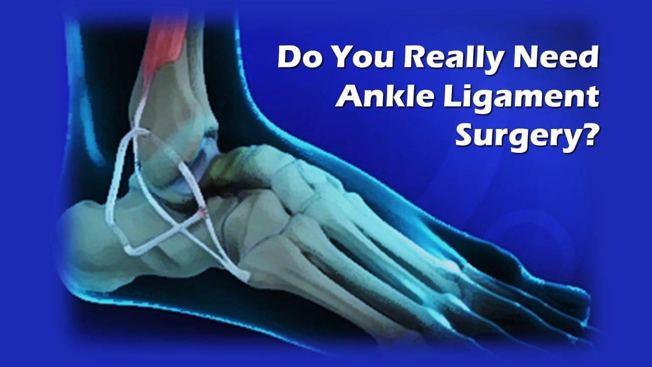 How painful is ankle ligament surgery?