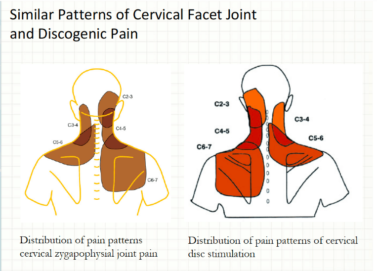 Cervical Spine Pain And Headaches