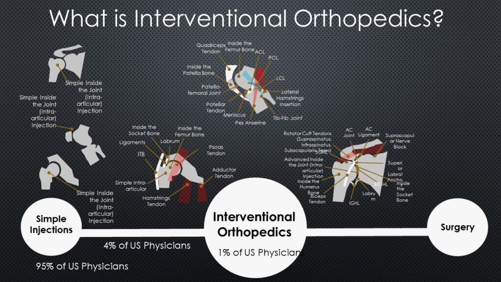 what is interventional orthopedics
