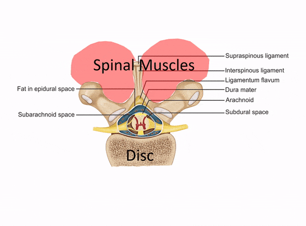 Stem Cell Therapy for Degenerative Disc Disease