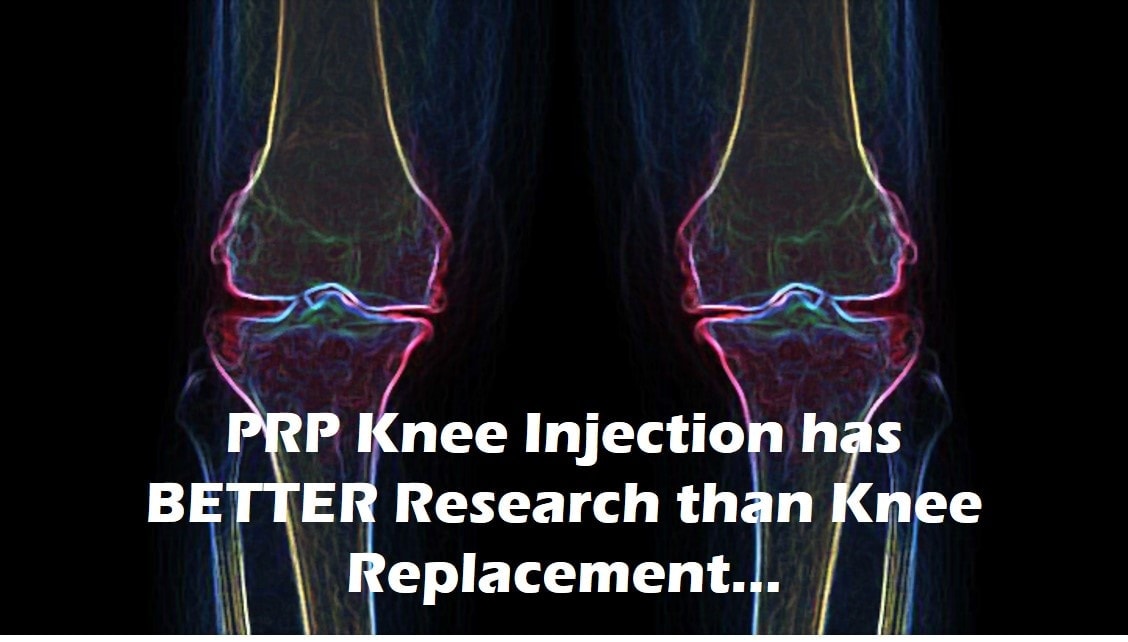 Should You Get Prp Knee Injection