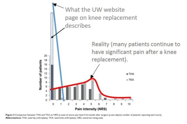 the truth about knee replacement 4