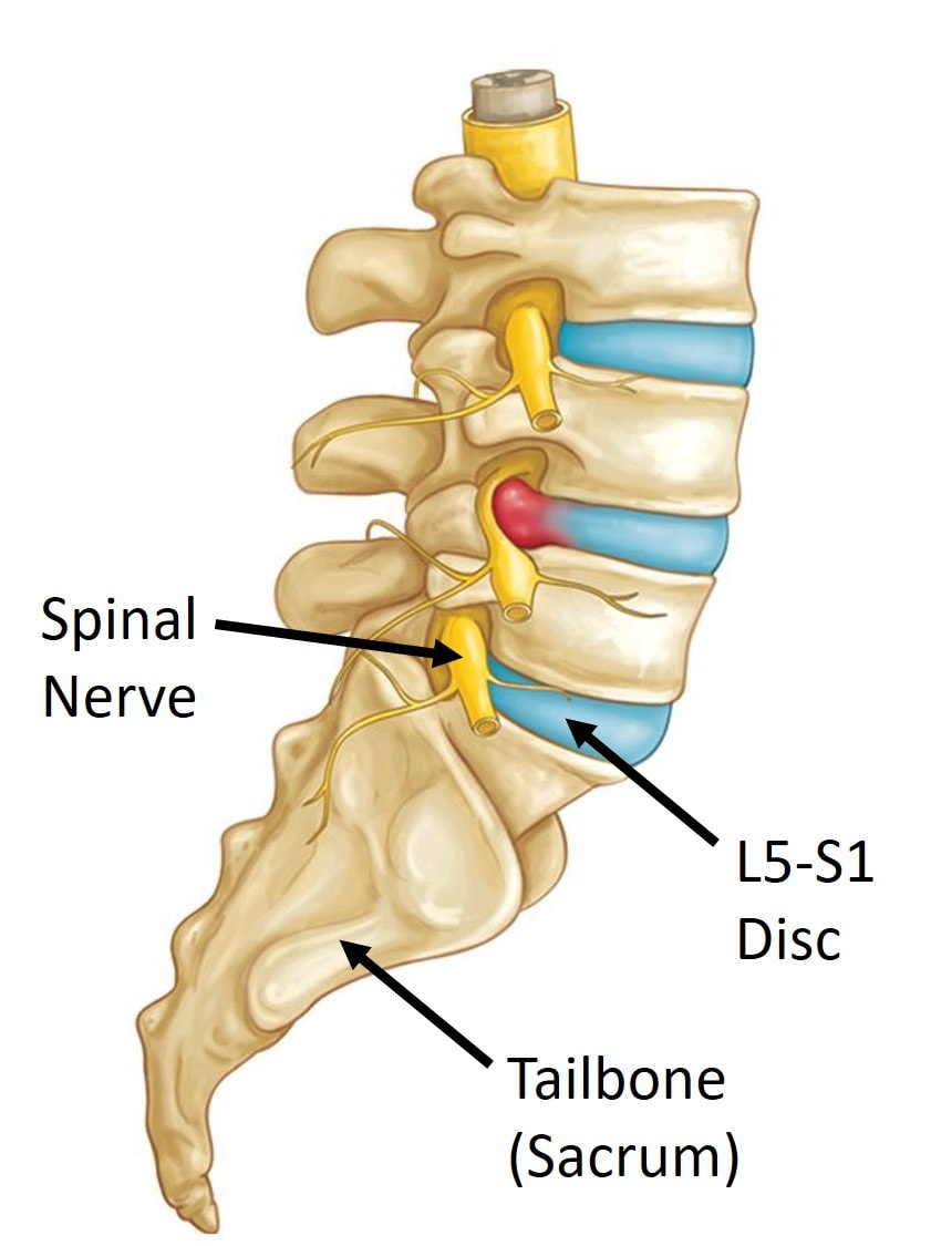 lumbar l5 s1