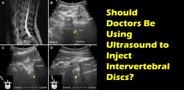 Spinal MRI and ultrasounds with the text: Should Doctors Be Using Ultrasounds to Inject Intervertebral Discs?