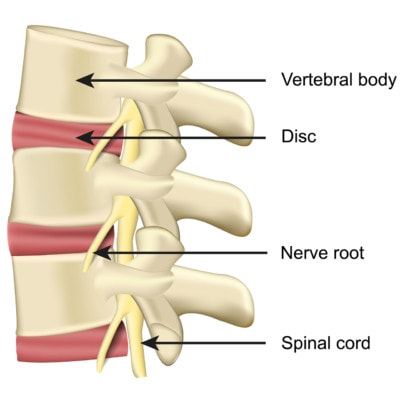 Medical illustration showing a section of the spine and its anatomy including discs