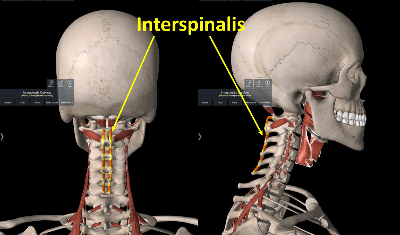 Interspinalis muscle cervical