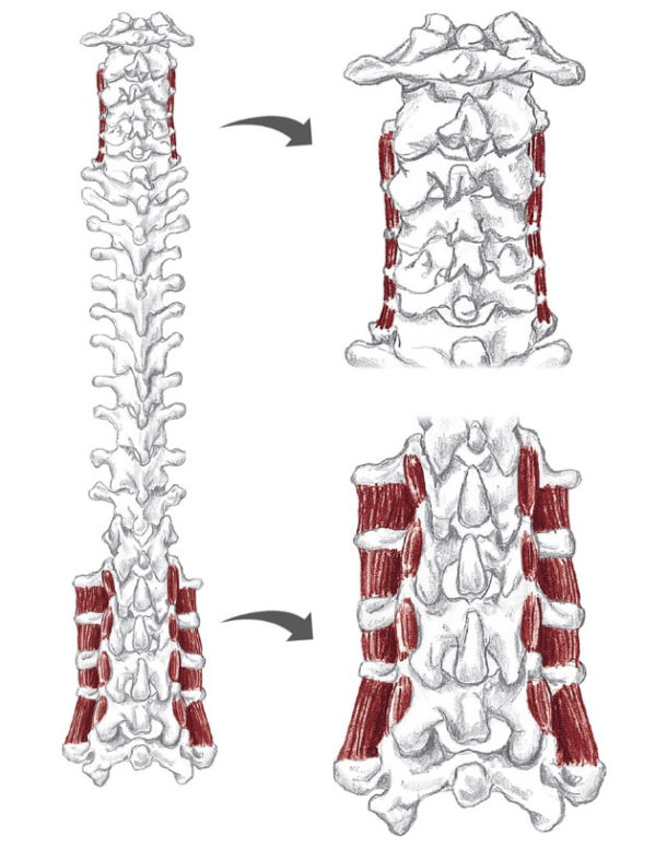 Are There Little Muscles in the Back Part of Your Spine? - Regenexx