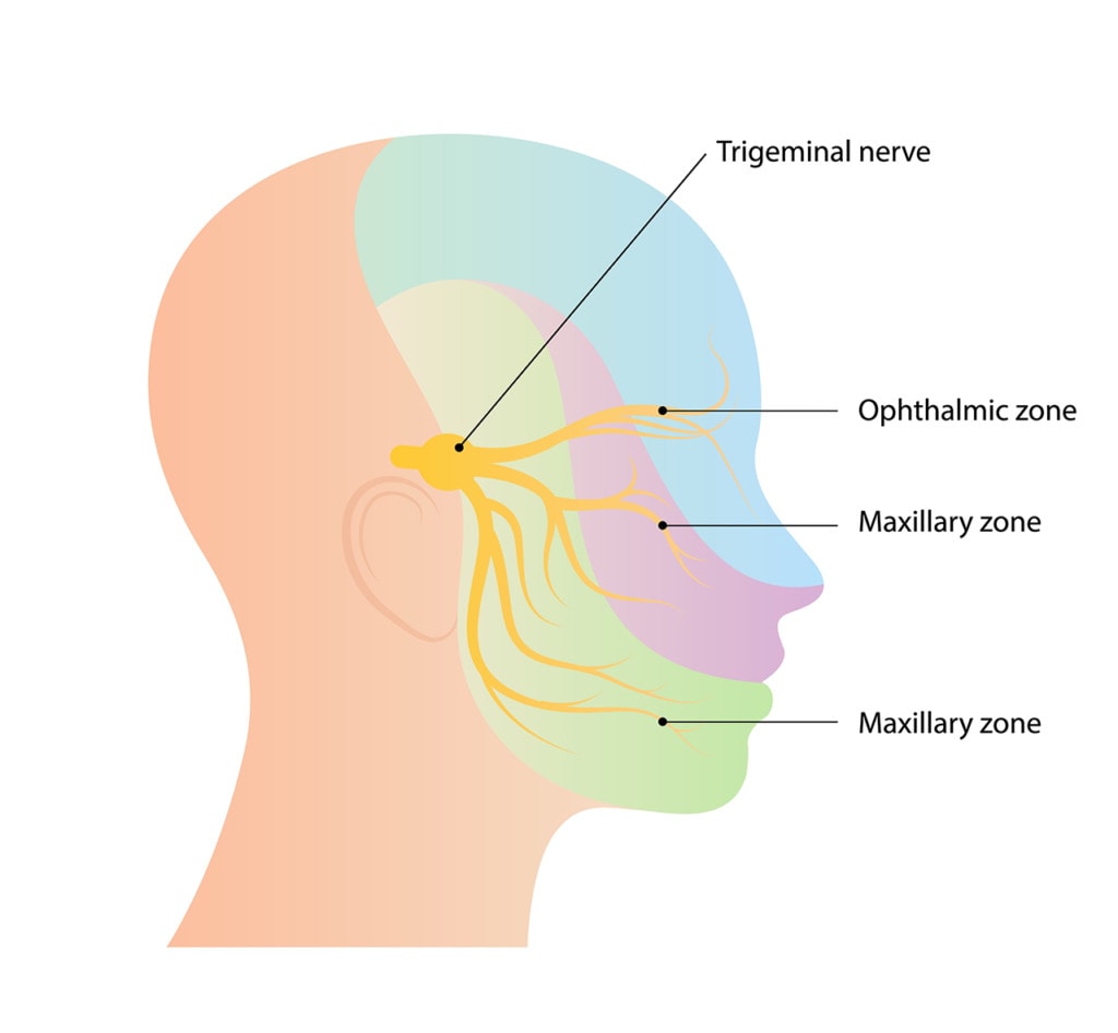 Could This Be a New Treatment for Trigeminal Neuralgia? Regenexx