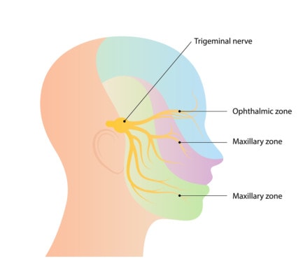 Illustration of trigeminal nerve anatomy showing the nerves orgin in the brain and corresponding zones in the face