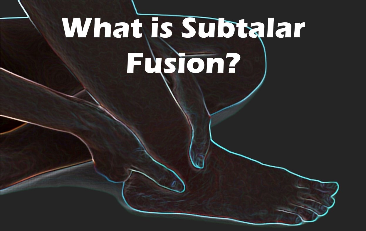 subtalar-fusion-do-you-really-need-this-surgery-regenexx