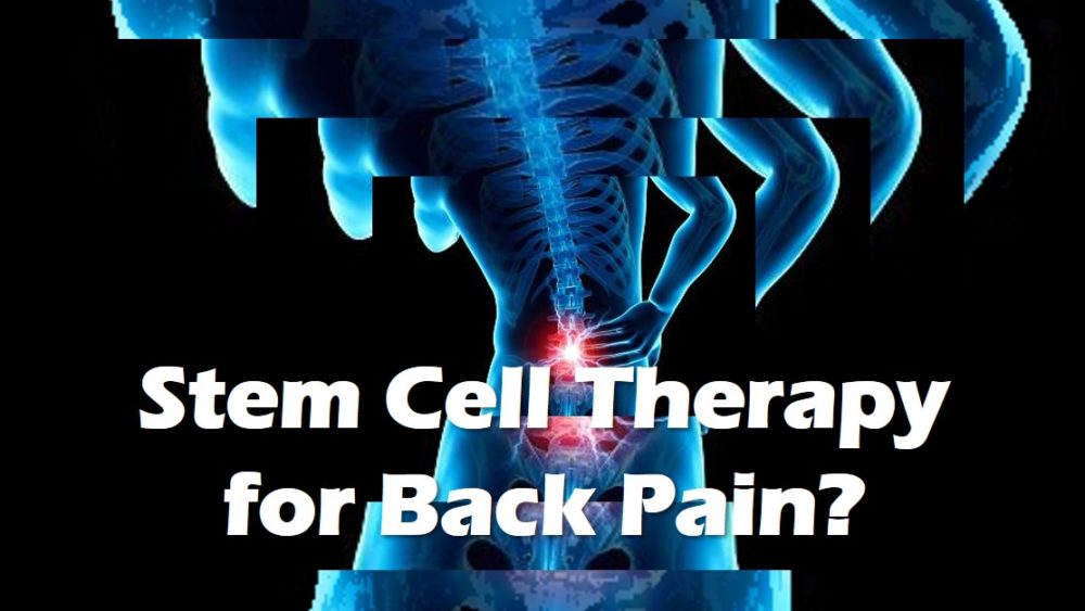 Stem Cell Therapy for Back Pain? Many Different Types
