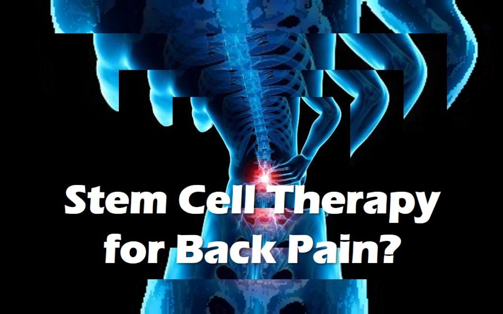 Stem Cell Therapy for Back Pain 2