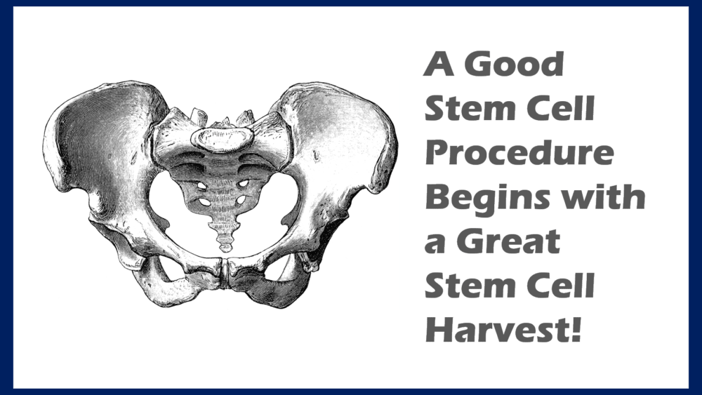 Bone Marrow Aspiration Is Where a Real Stem Cell Procedure Begins