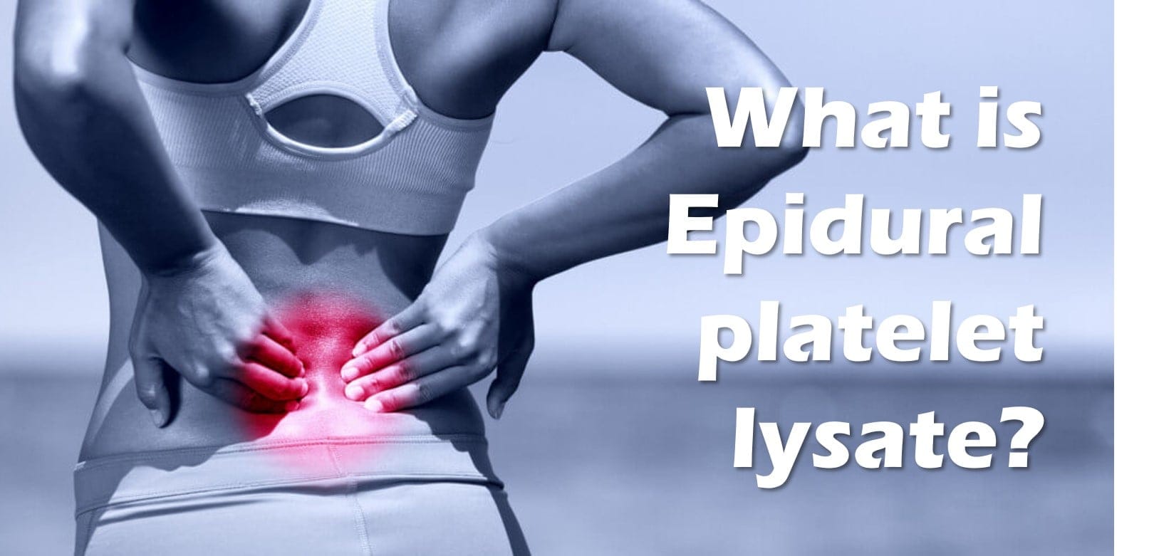 Steroid vs. Platelet Lysate Epidurals One Woman's 10Year+ Result